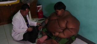 Jinsi ya Kupunguza Unene kwa Siku 7