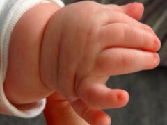 Zifahamu Sababu za Mtoto Kuzaliwa na Vidole Sita