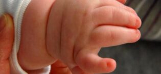 Zifahamu Sababu za Mtoto Kuzaliwa na Vidole Sita Zifahamu Sababu za Mtoto Kuzaliwa na Vidole Sita